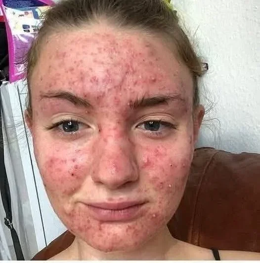 His body was itchy, he thought it was an allergy – DAILY DAILYS