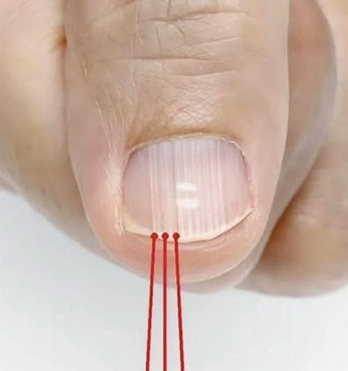 What Those Vertical Ridges on Your Fingernails Might Be Telling You — Especially After 40